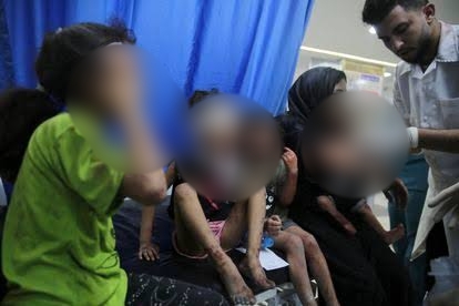 Anak-anak di Jalur Gaza, Palestina, sedang mendapatkan perawatan medis. WHO menyebutkan, 160 anak-anak di Gaza meninggal dunia setiap hari akibat agresi Israel.